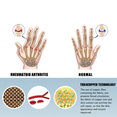 Baumwolle Handschuhe mit Druck gegen Arthritis